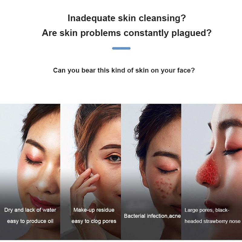 Electric Small Bubble Blackhead Remover USB Rechargeable Water Cycle Pore Acne Pimple Removal Vacuum Suction Facial Cleaner Tool - 2bazar4