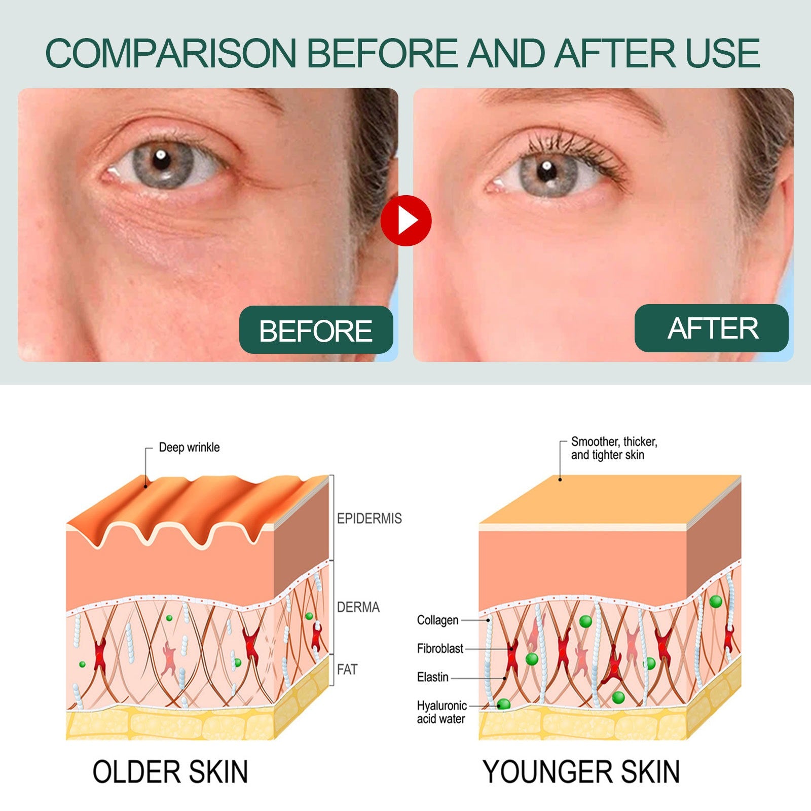 OUHOE Essence collagen replenishing essence whitening freckle removal facial essence brightening hydrating moisturizing - 2bazar4