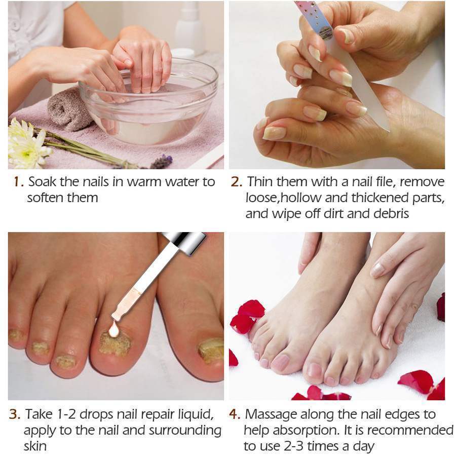Vibrant Glamour Nail Repair Fluid Hand and Foot Nail Fungus Care Bright Nail - 2bazar4