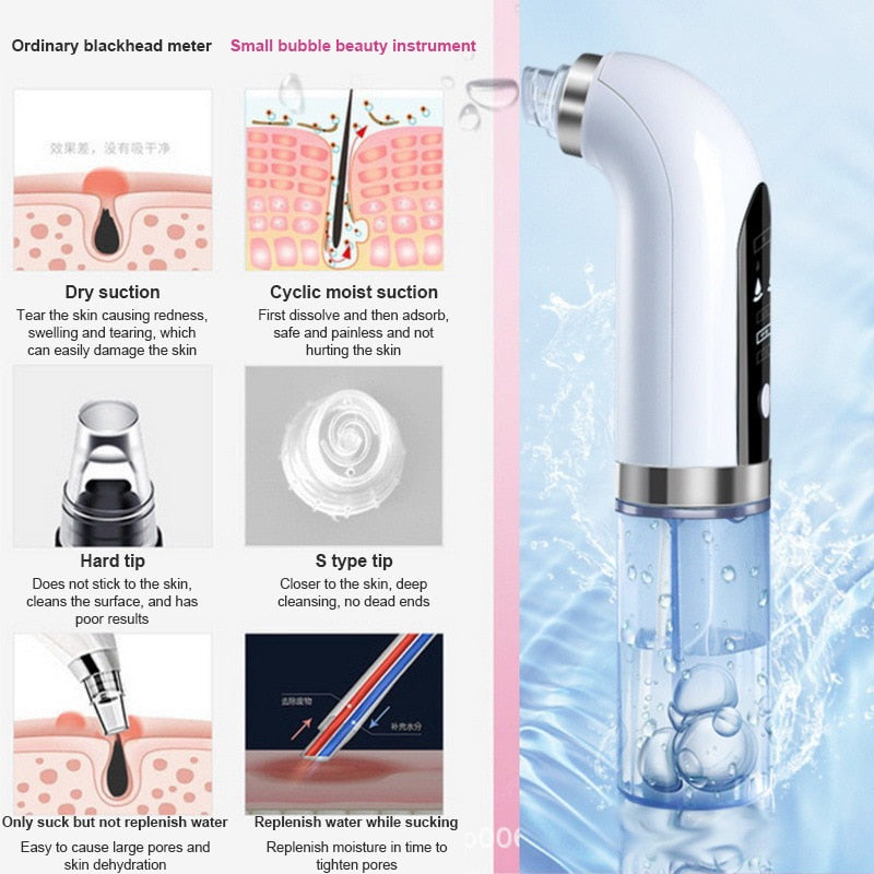 Electric Small Bubble Blackhead Remover USB Rechargeable Water Cycle Pore Acne Pimple Removal Vacuum Suction Facial Cleaner Tool - 2bazar4