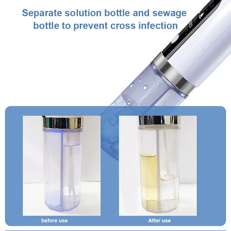 Electric Small Bubble Blackhead Remover USB Rechargeable Water Cycle Pore Acne Pimple Removal Vacuum Suction Facial Cleaner Tool - 2bazar4