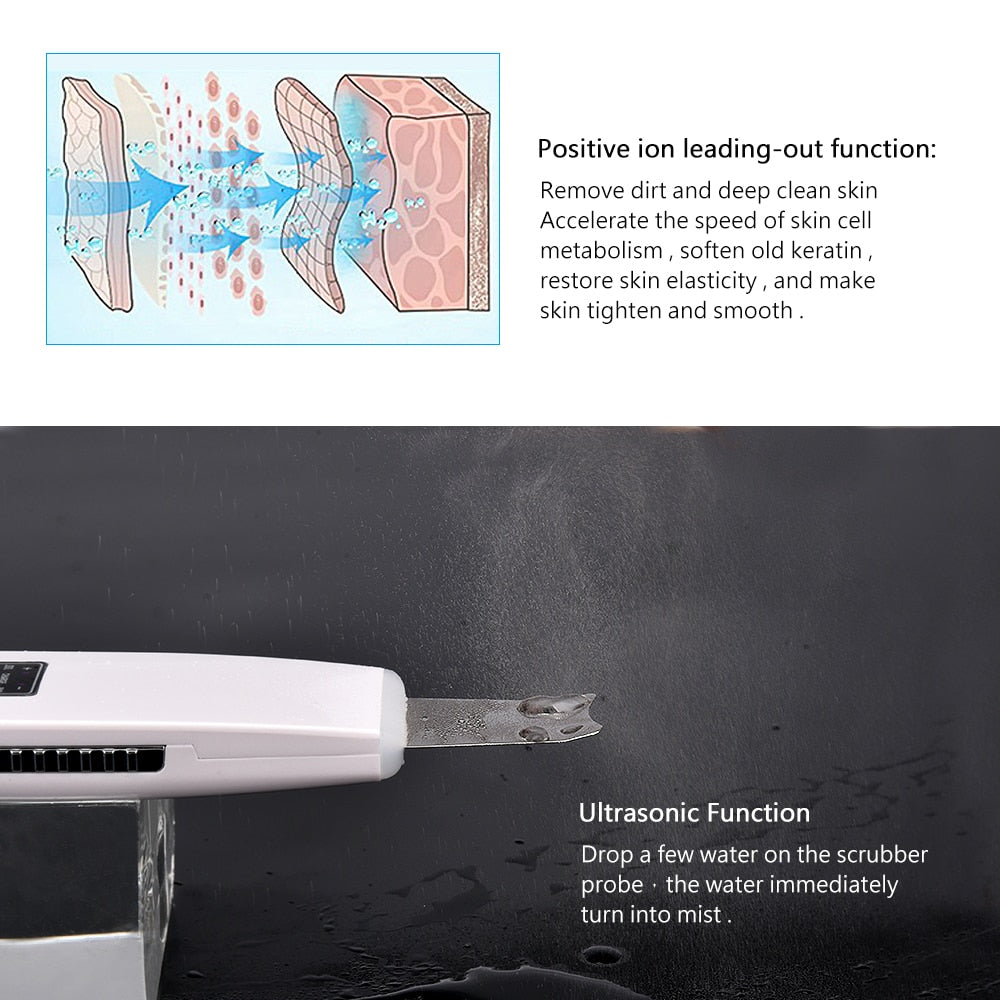 Ultrasonic Remove Blackhead Wrinkle Pore Clean  Face Scrubber Machine - 2bazar4