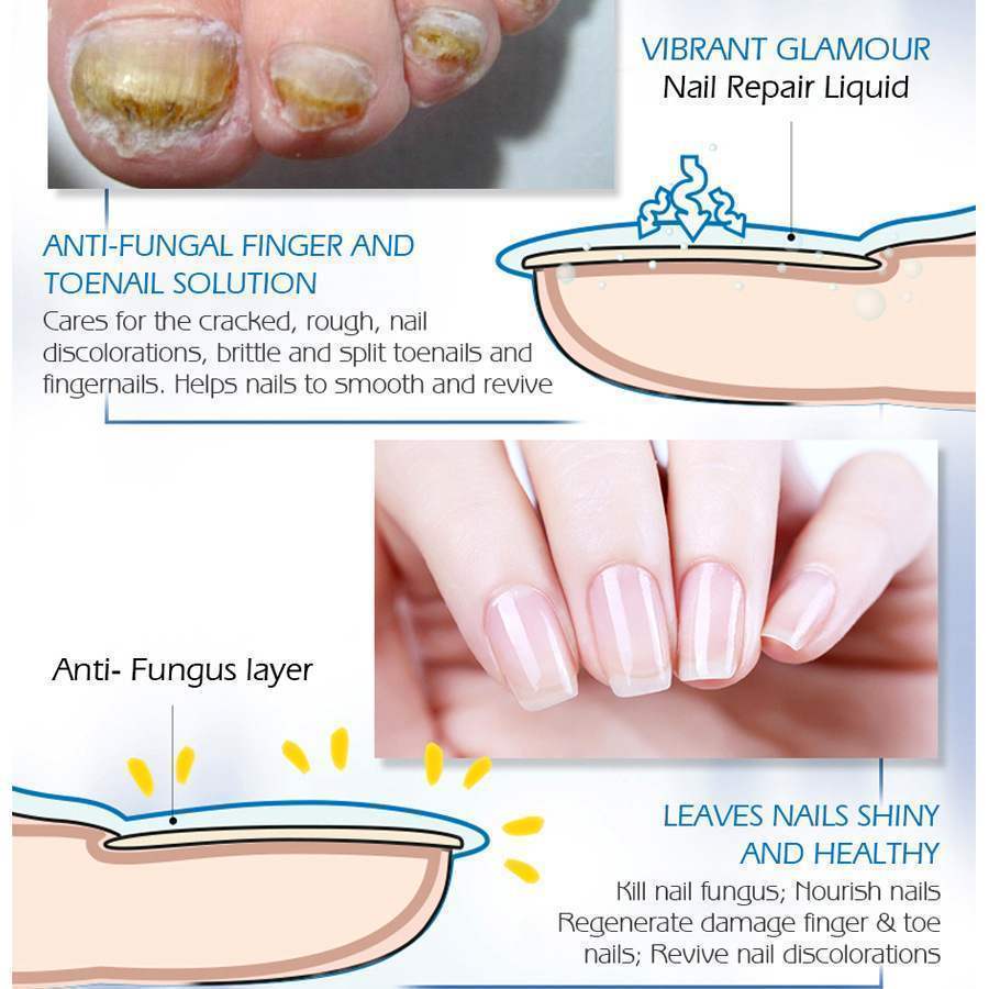 Vibrant Glamour Nail Repair Fluid Hand and Foot Nail Fungus Care Bright Nail - 2bazar4